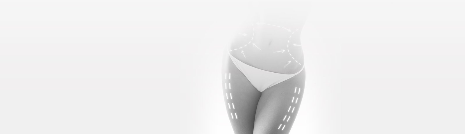 Plastische Chirurgie nach der Schwangerschaft Türkei
